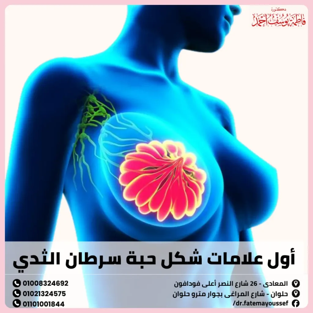 اول علامات شكل حبة سرطان الثدي