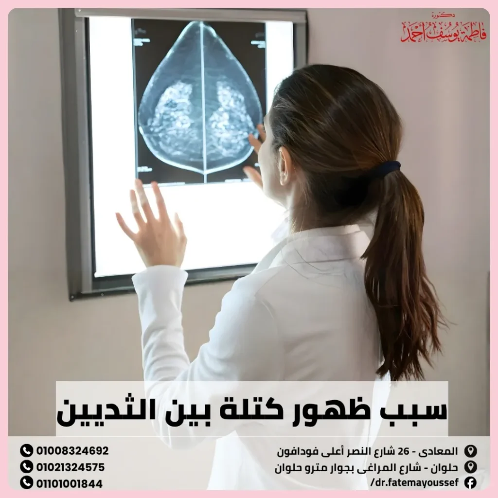 سبب ظهور كتلة بين الثديين