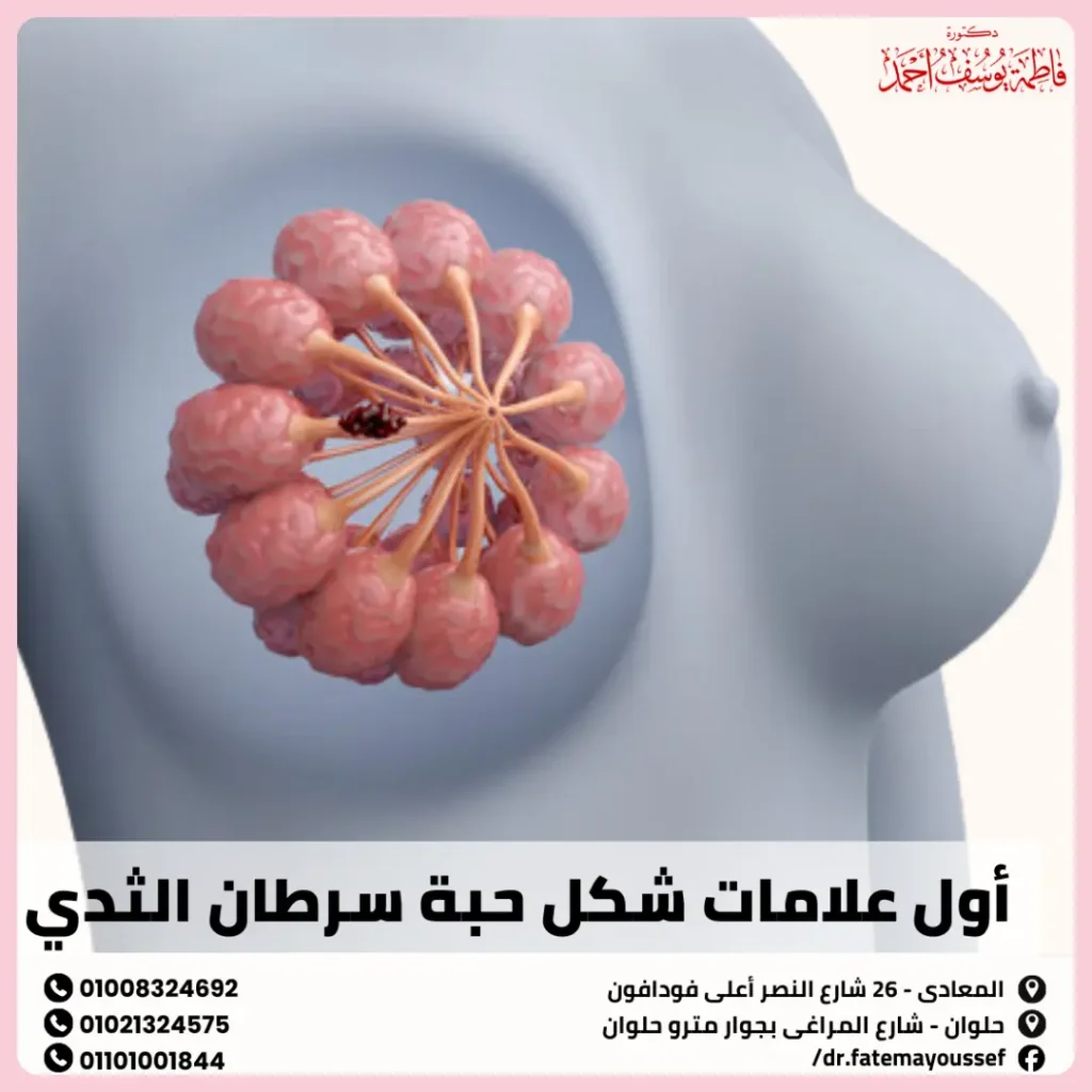 اول علامات شكل حبة سرطان الثدي