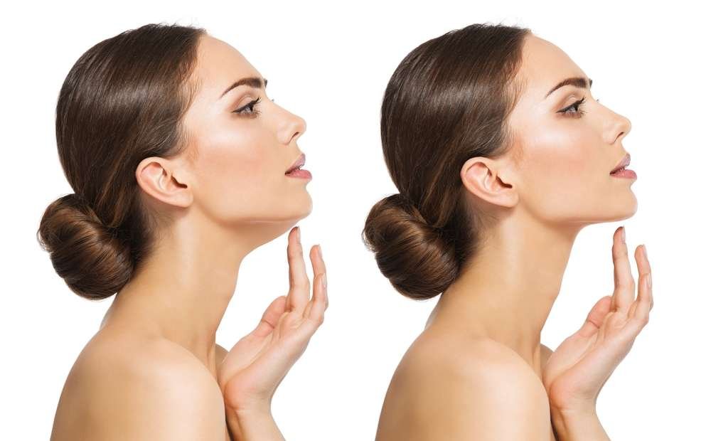 التجميل الغير جراحي