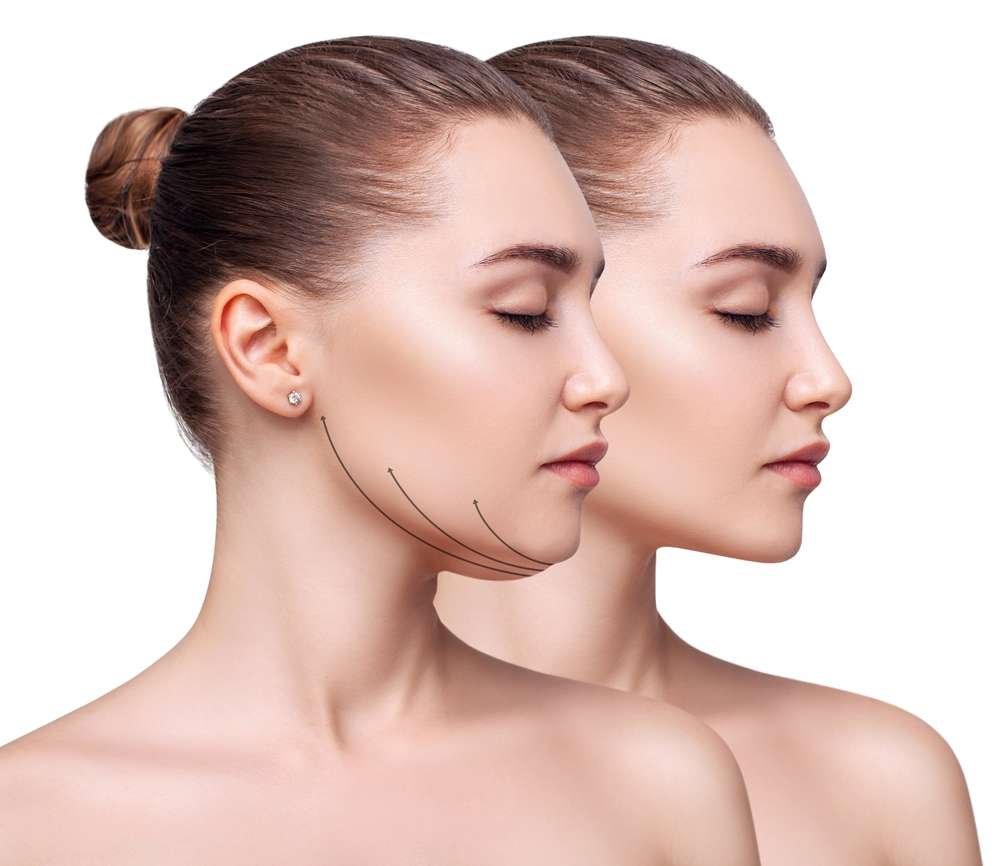 جراحة تجميل الوجه والفكين