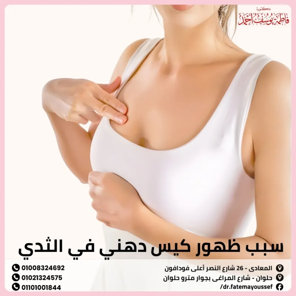 سبب ظهور كيس دهني في الثدي
