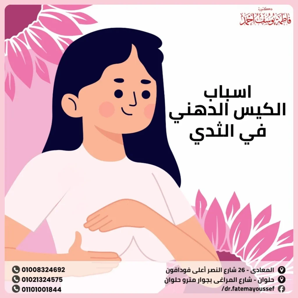 اسباب الكيس الدهني في الثدي