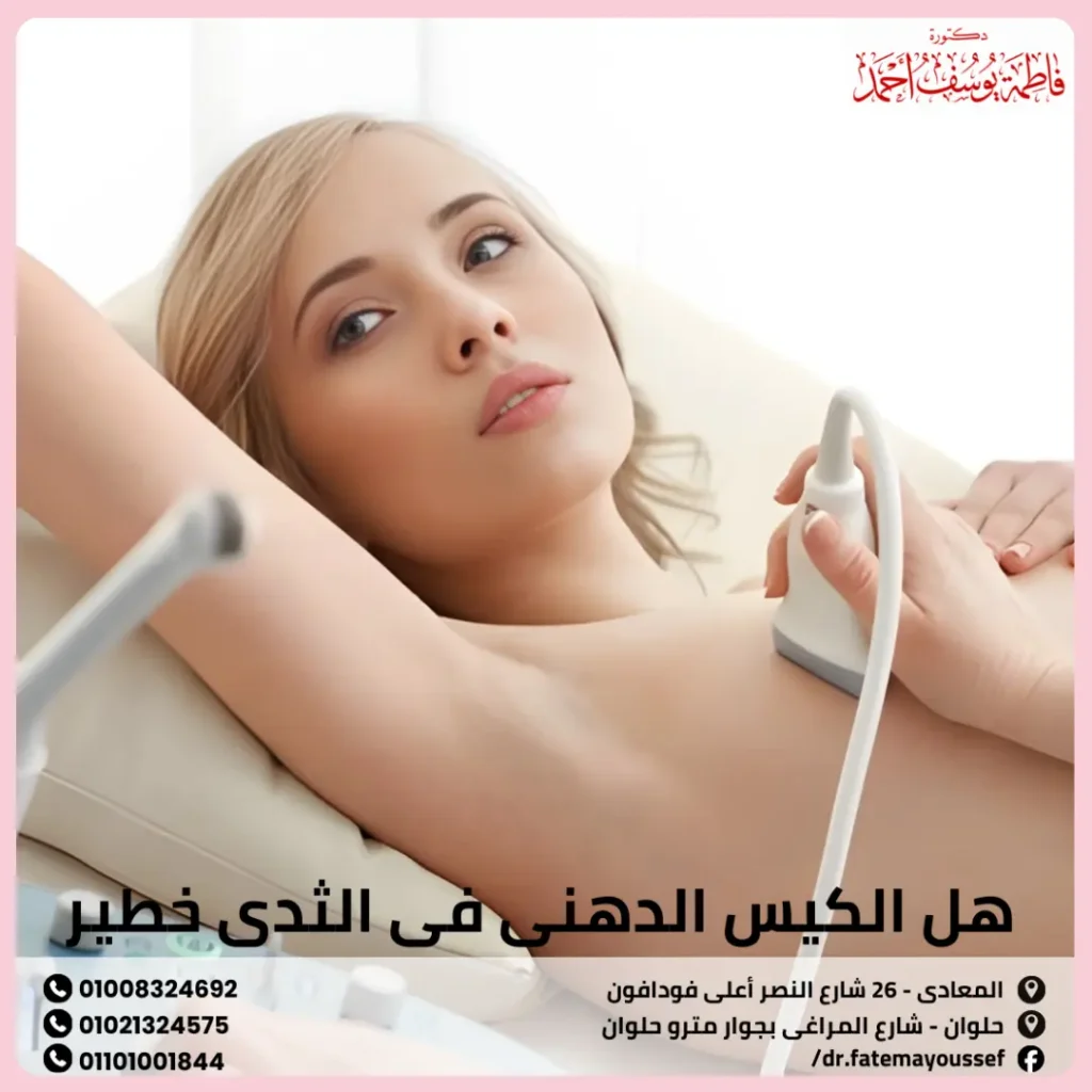 هل الكيس الدهني في الثدي خطير