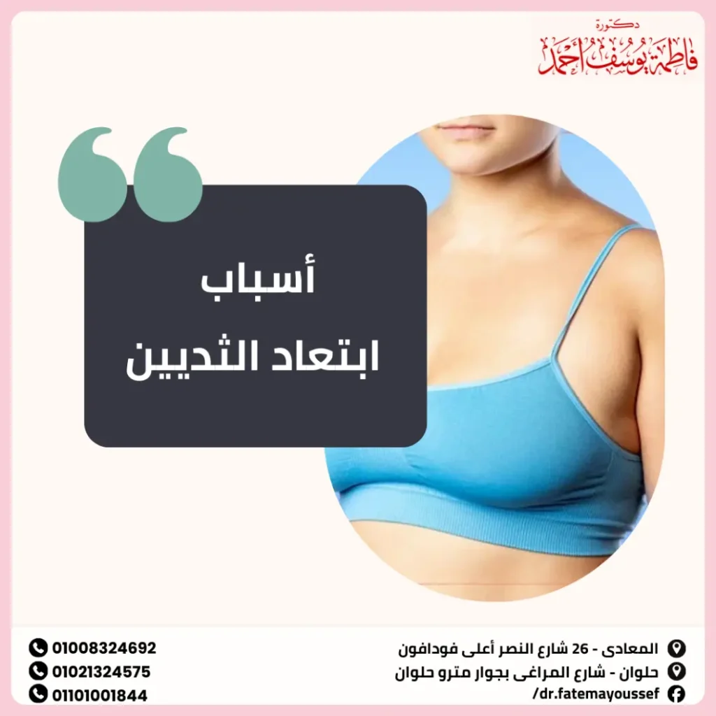 سبب ابتعاد الثديين