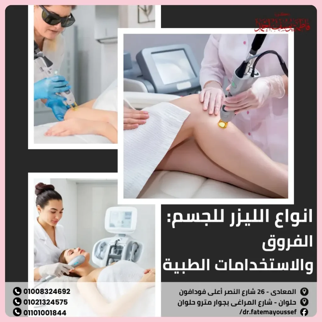 انواع الليزر للجسم
