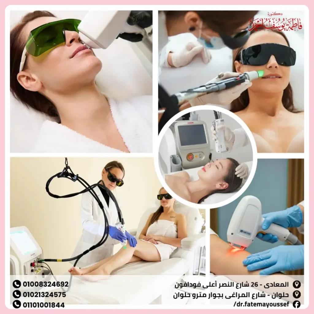 انواع الليزر للجسم
