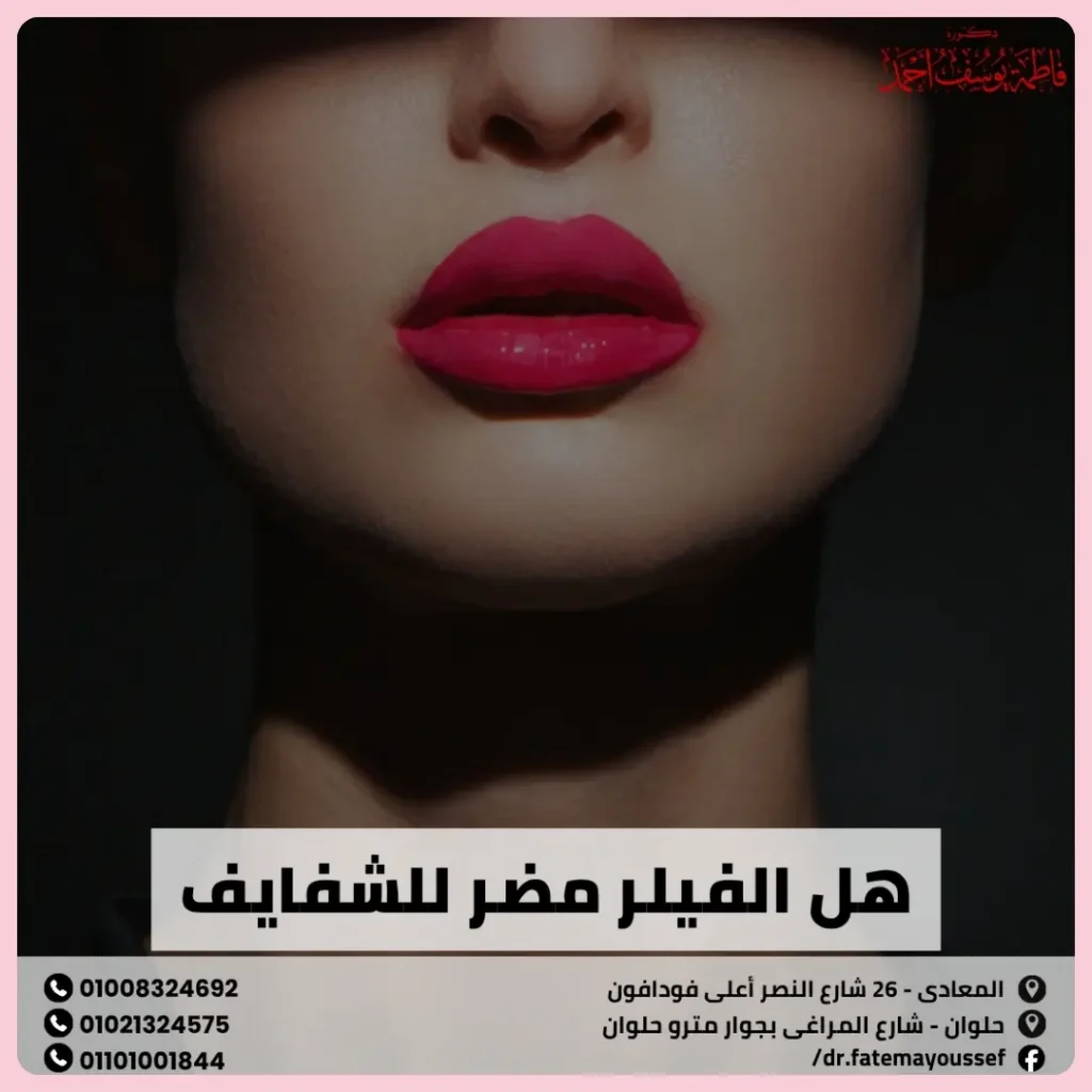 هل الفيلر مضر للشفايف