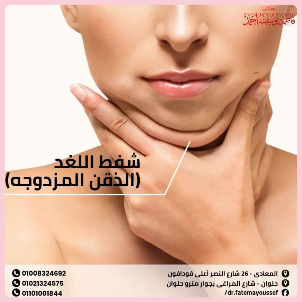 شفط اللغد (الذقن المزدوجه)