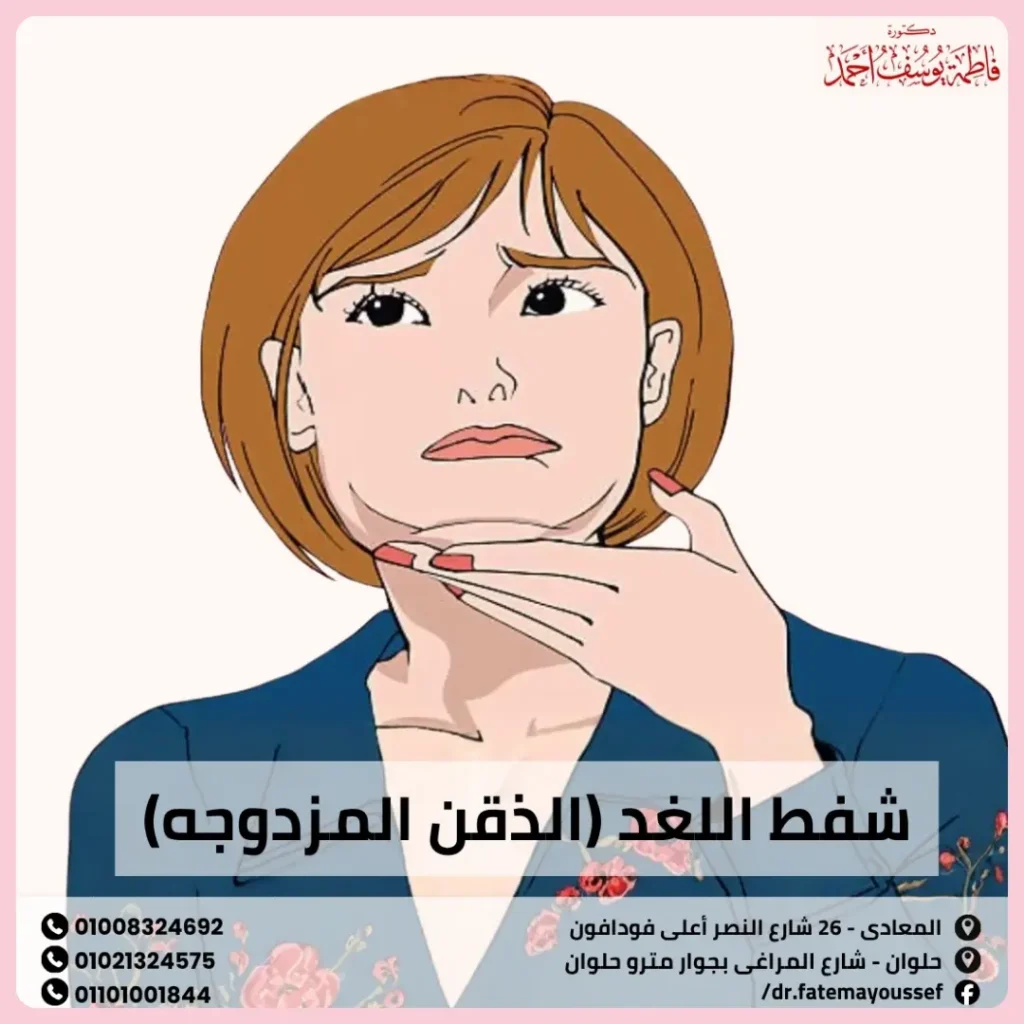 شفط اللغد (الذقن المزدوجه)