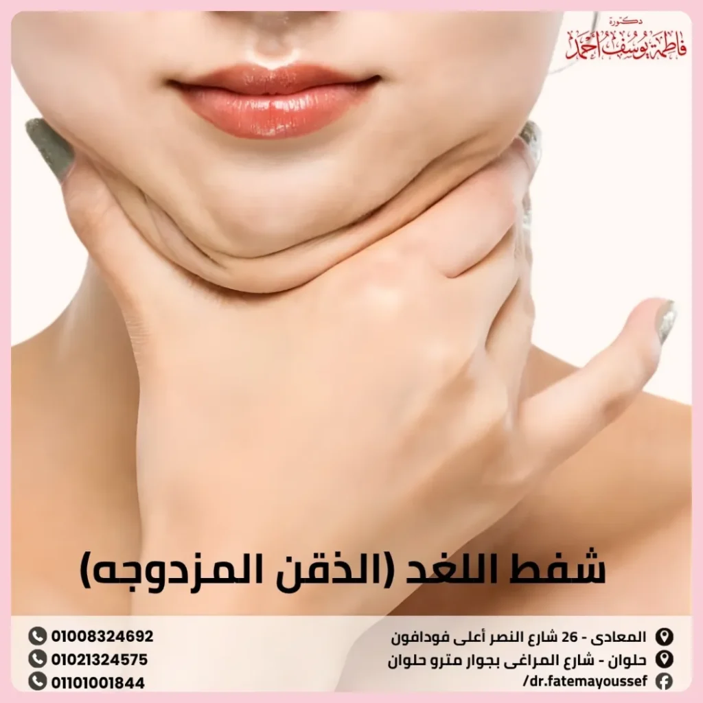 شفط اللغد (الذقن المزدوجه)