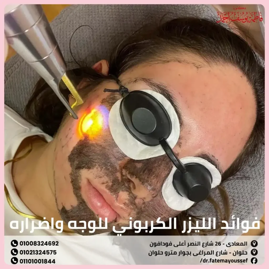 فوائد الليزر الكربوني للوجه واضراره