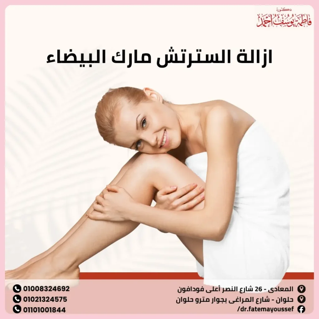 أسباب السترتش مارك البيضاء