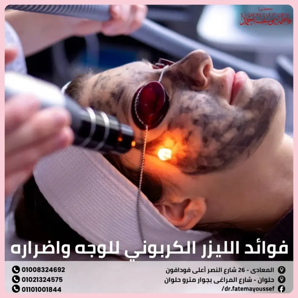 فوائد الليزر الكربوني للوجه واضراره