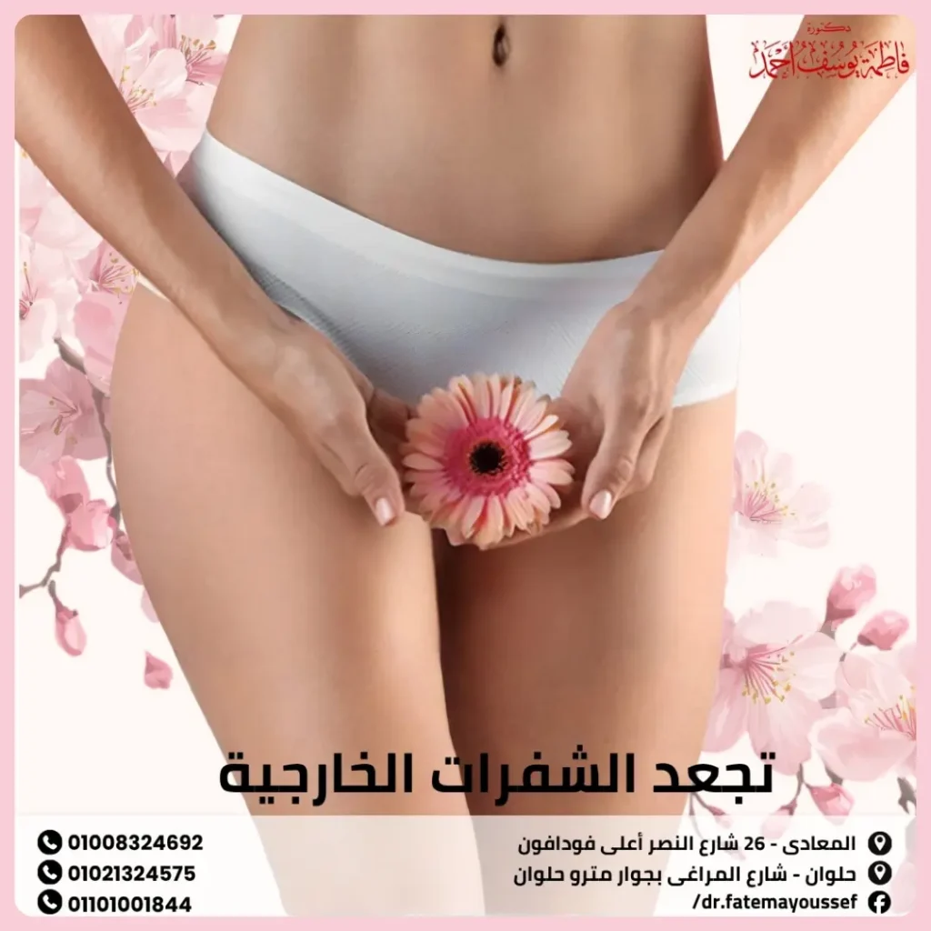 تجعد الشفرات الخارجية