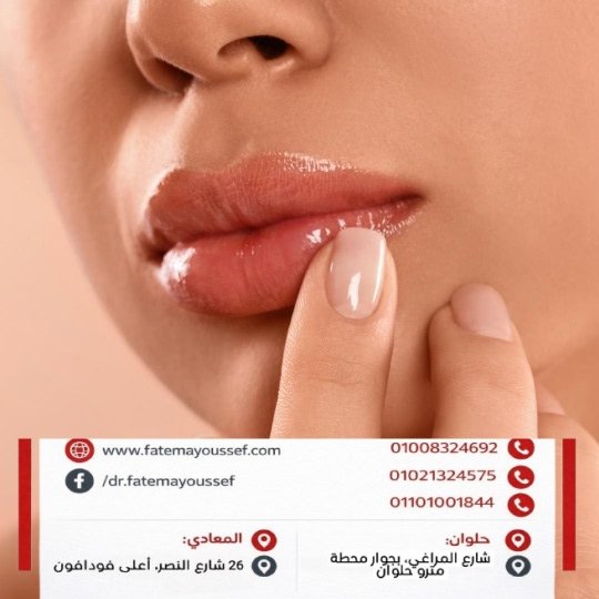 كيف اخفف تورم الشفايف بعد الفيلر