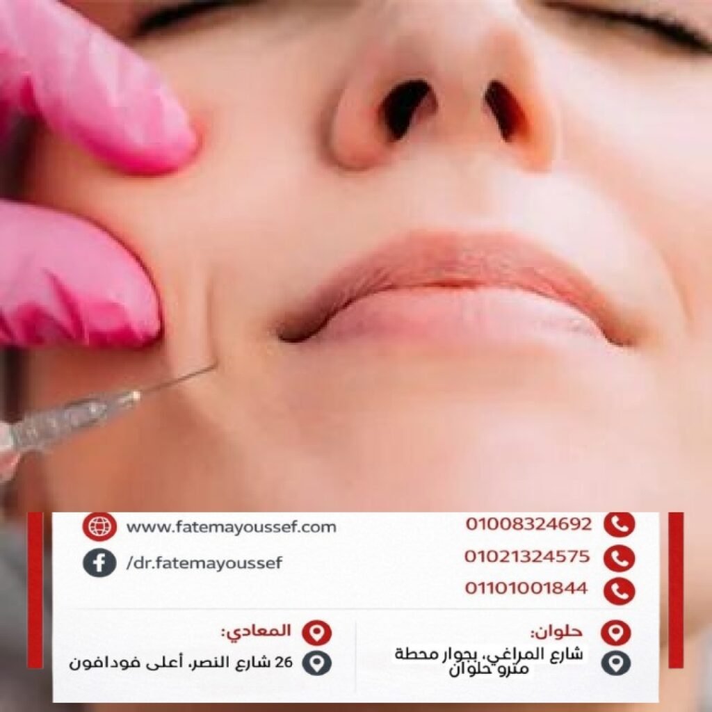 كيفية حقن فيلر الخدود