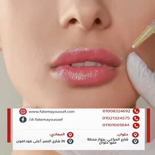 كريم لتخفيف تورم الشفايف بعد الفيلر