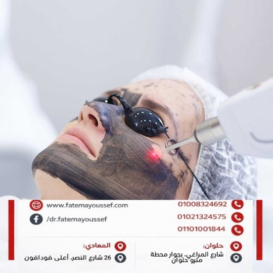 فوائد الليزر الكربوني للوجه واضراره