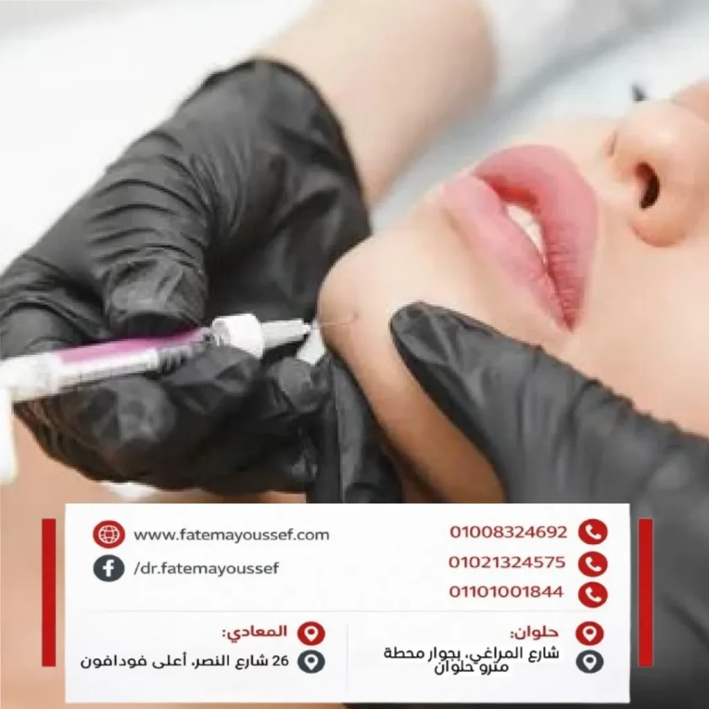 كيفية حقن فيلر الذقن