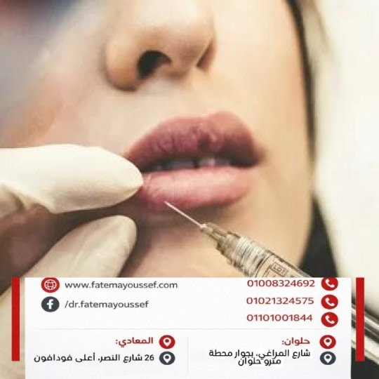 هل الفيلر مضر للشفايف