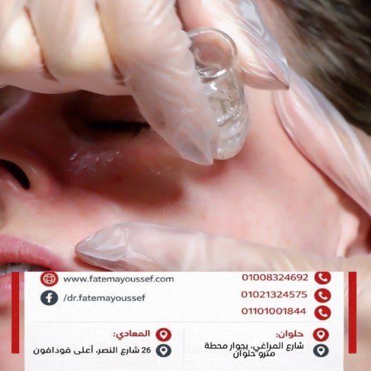 أضرار غسل الوجه بعد البلازما