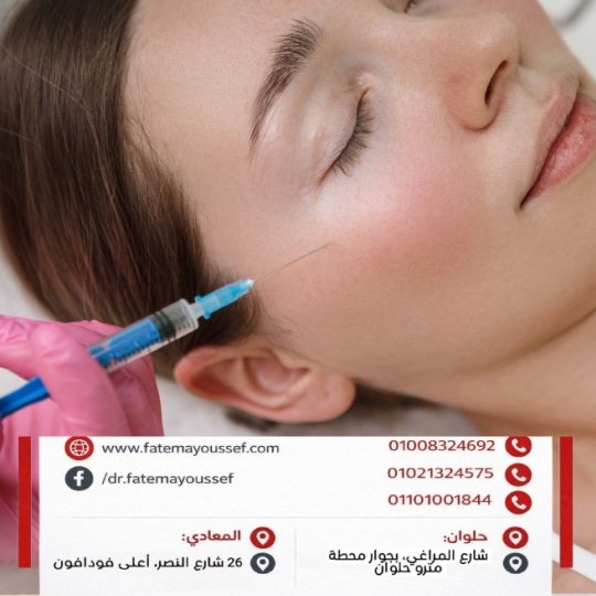 طريقة حقن فيلر الخدود