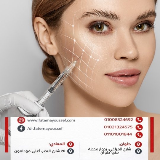 طريقة حقن فيلر الخدود