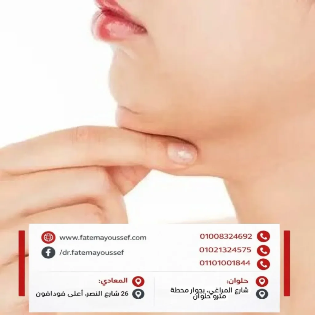 شفط اللغد (الذقن المزدوجه)