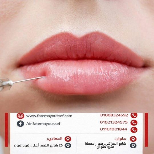 متى اقدر أكل بعد فيلر الشفايف