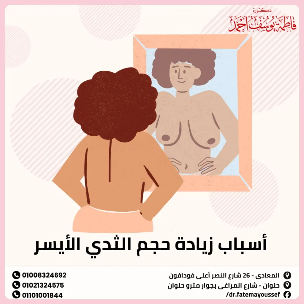 أسباب زيادة حجم الثدي الأيسر