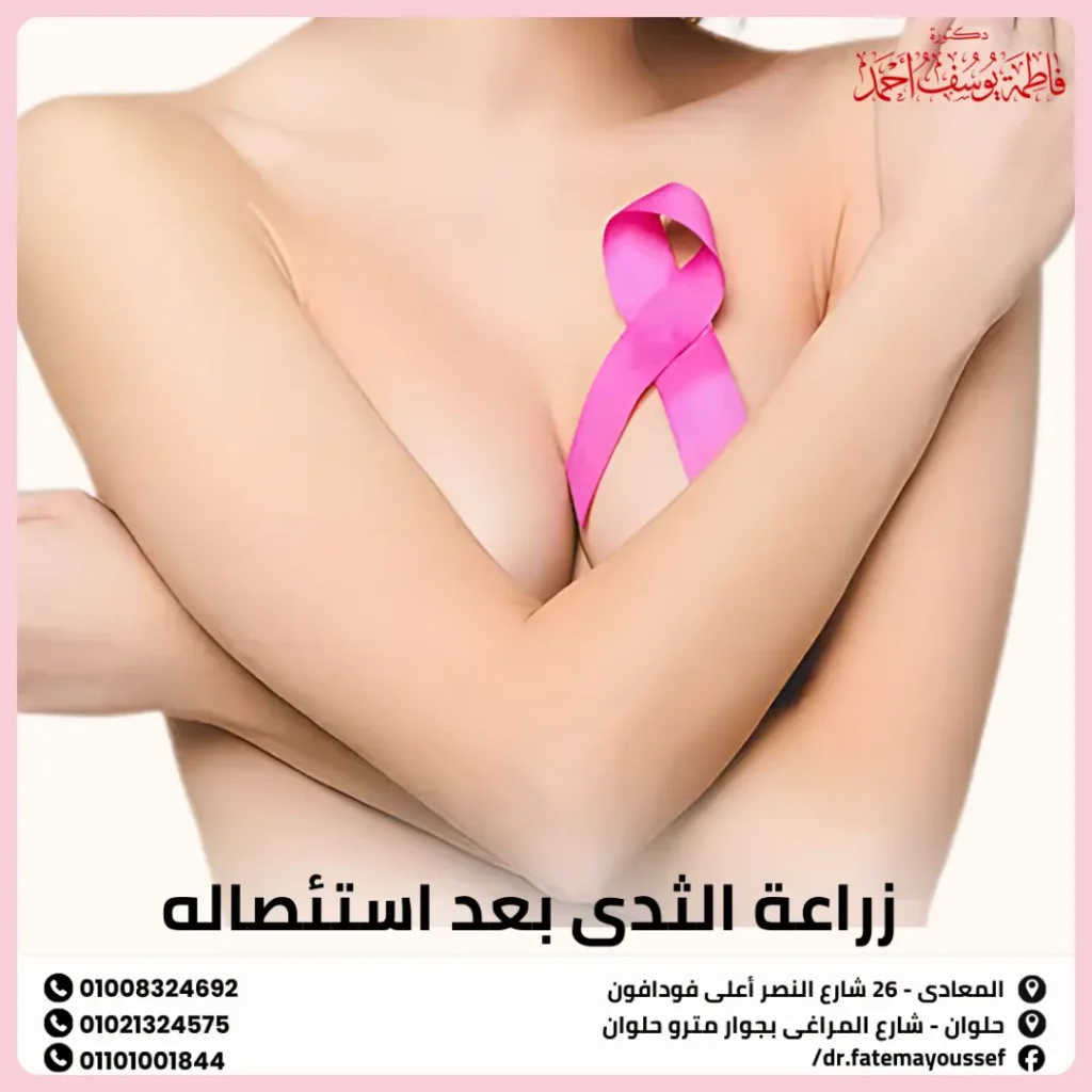زراعة الثدي بعد استئصاله