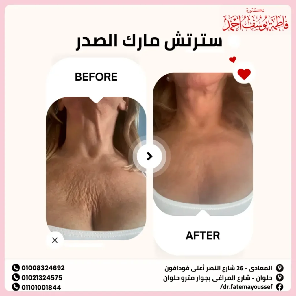 سترتش مارك الصدر