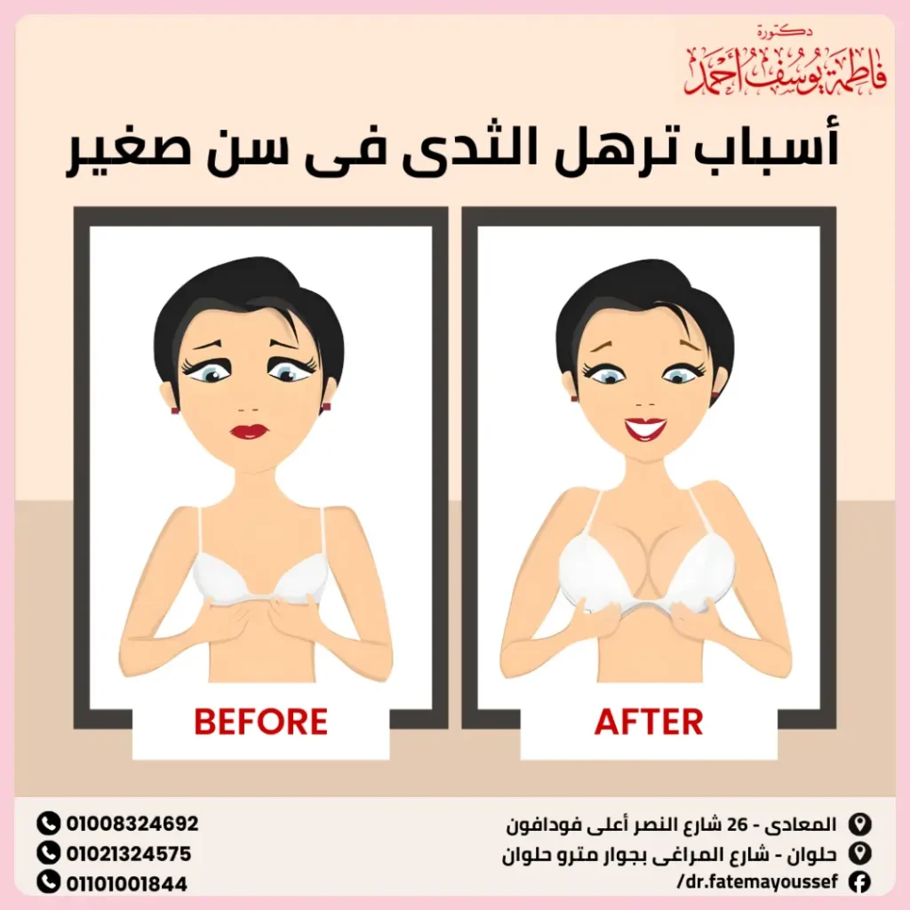 أسباب ترهل الثدي في سن صغير