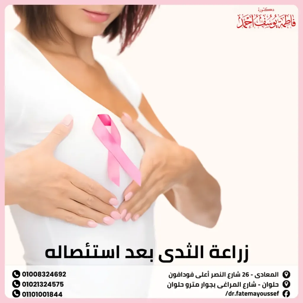 زراعة الثدي بعد استئصاله