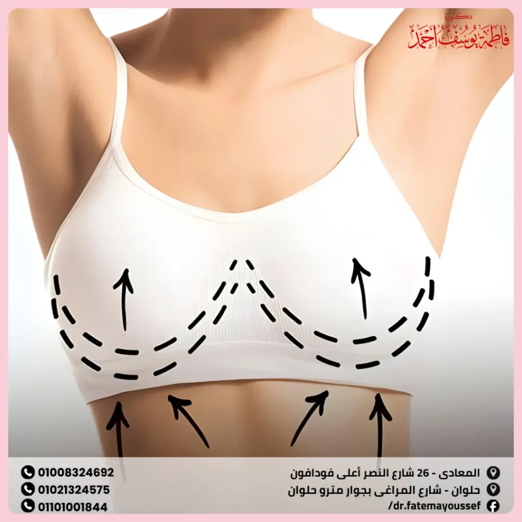 عمليات شد الثدي قبل وبعد