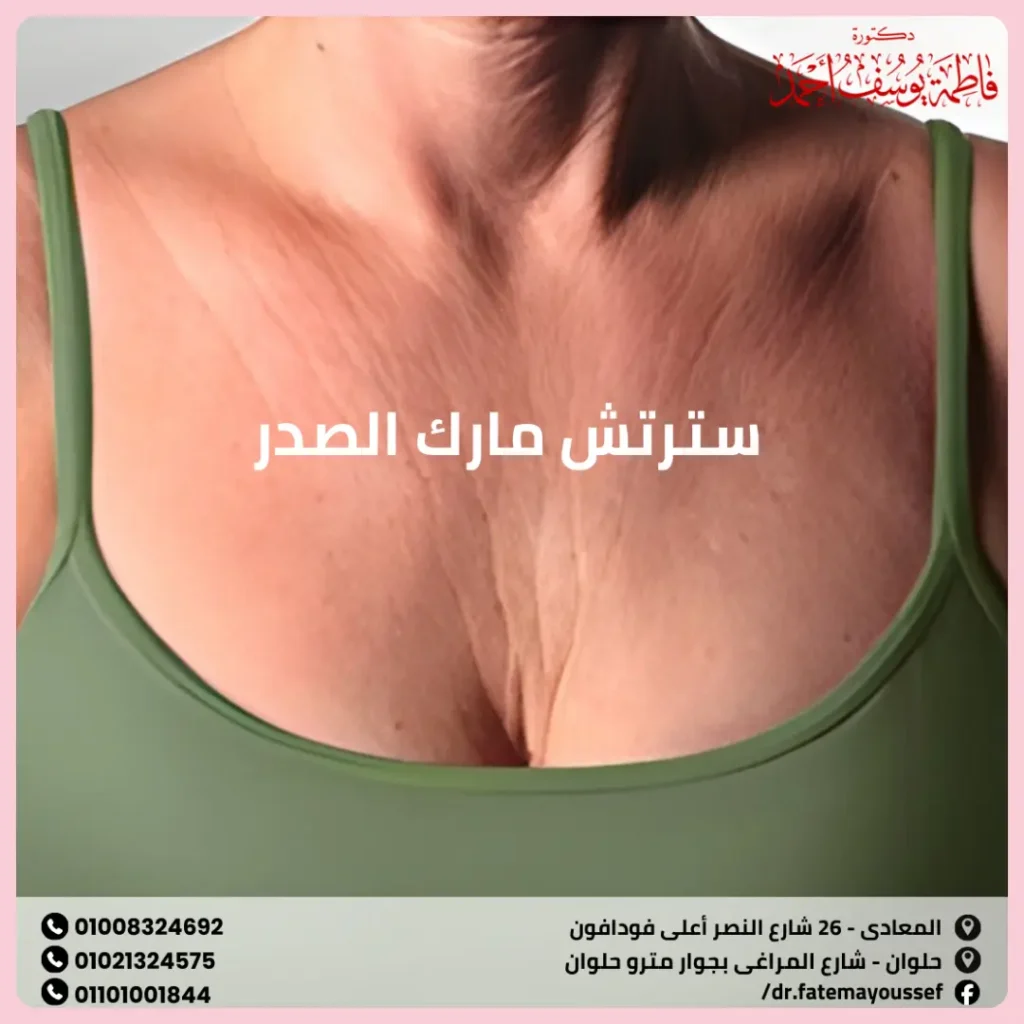 سترتش مارك الصدر