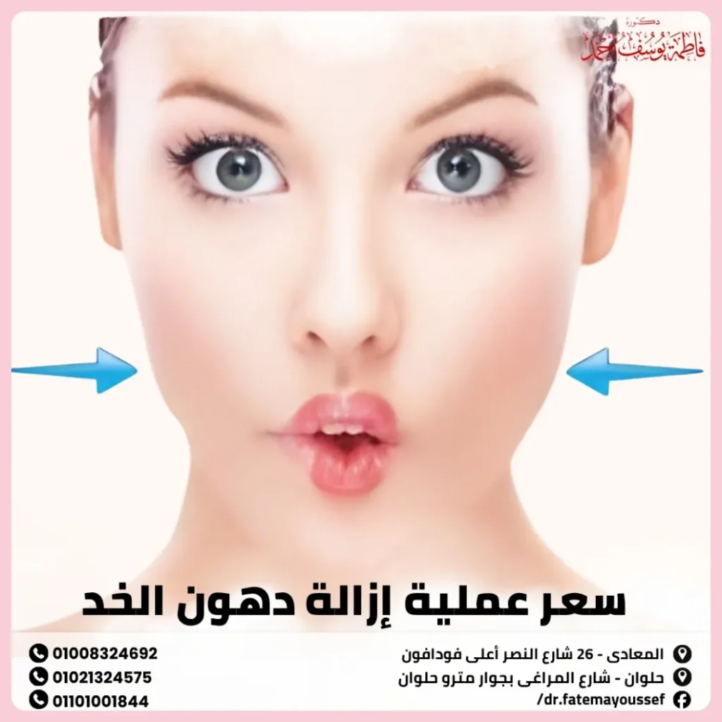 سعر عملية إزالة دهون الخد