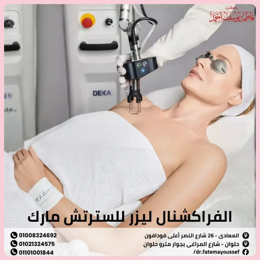 الفراكشنال ليزر للسترتش مارك