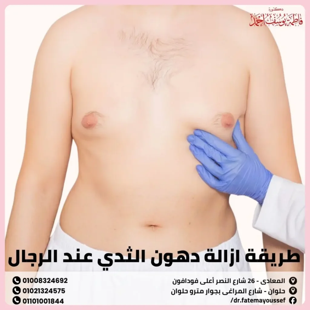 طريقة ازالة دهون الثدي عند الرجال