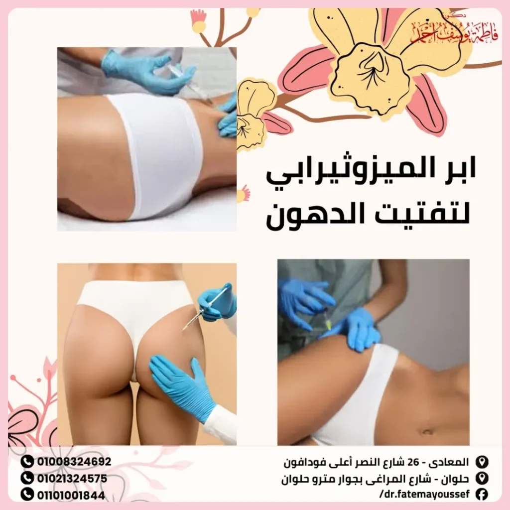 ابر الميزوثيرابي لتفتيت الدهون