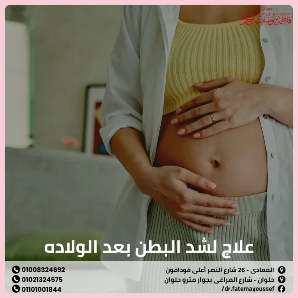 علاج لشد البطن بعد الولاده