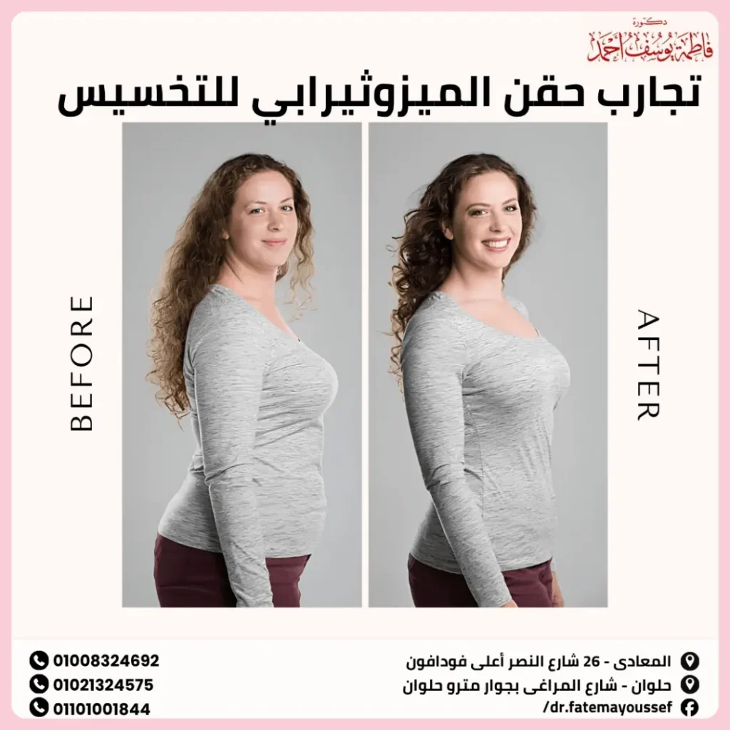 تجارب حقن الميزوثيرابي للتخسيس