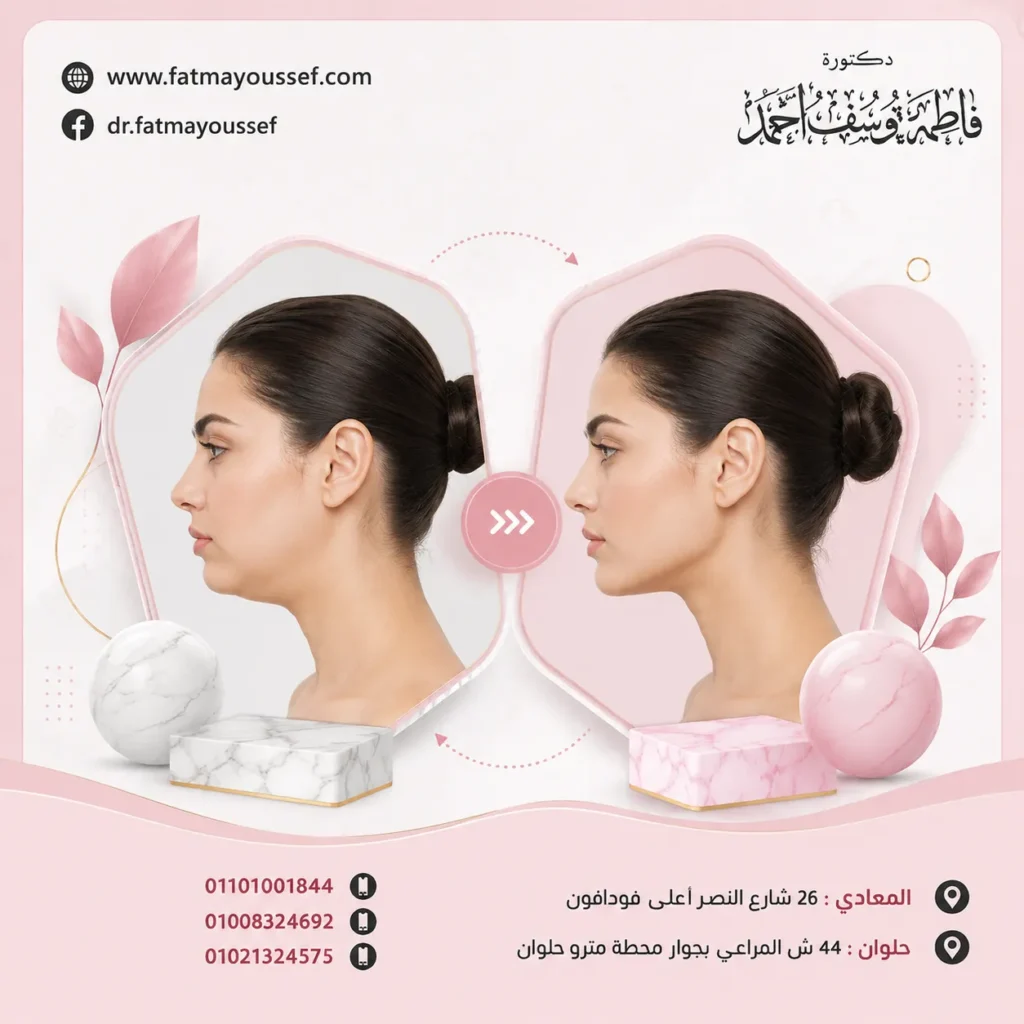 عملية تعريض الفك قبل وبعد