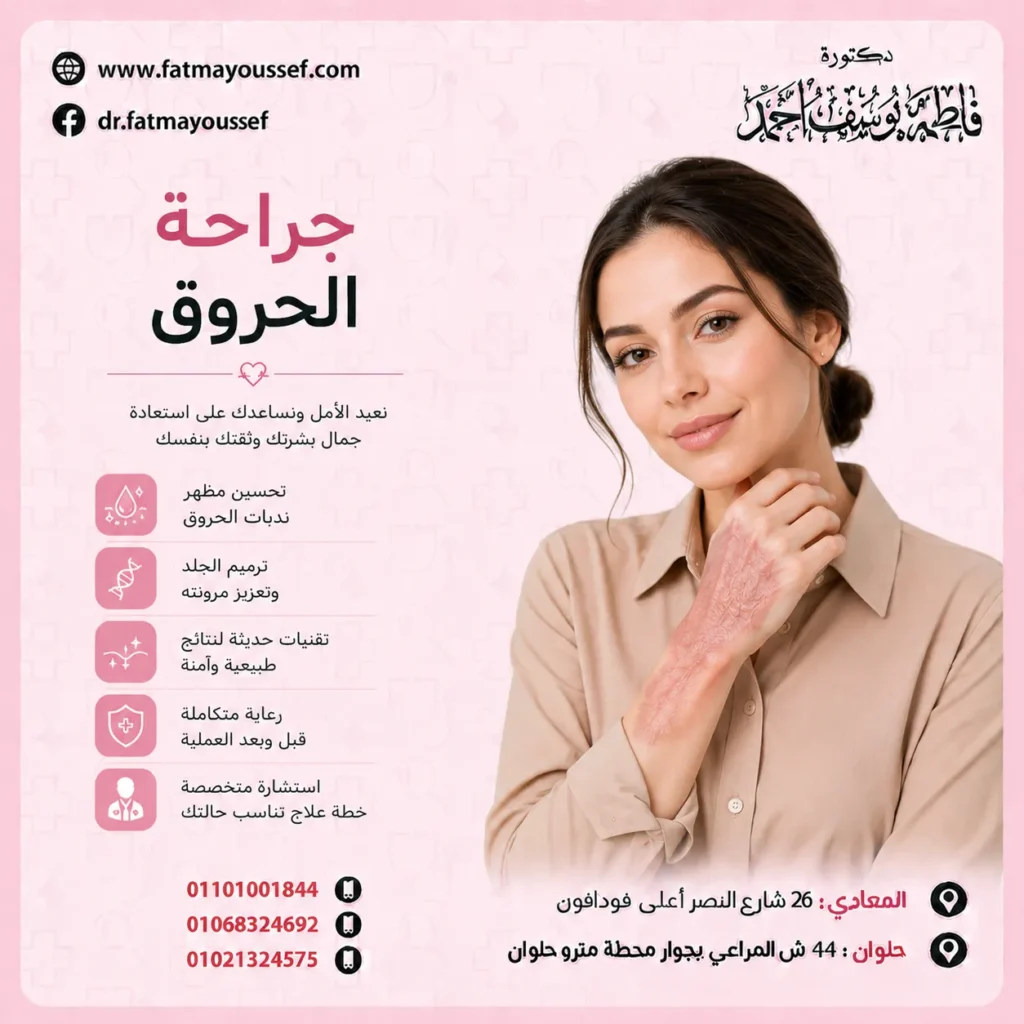 جراحة الحروق