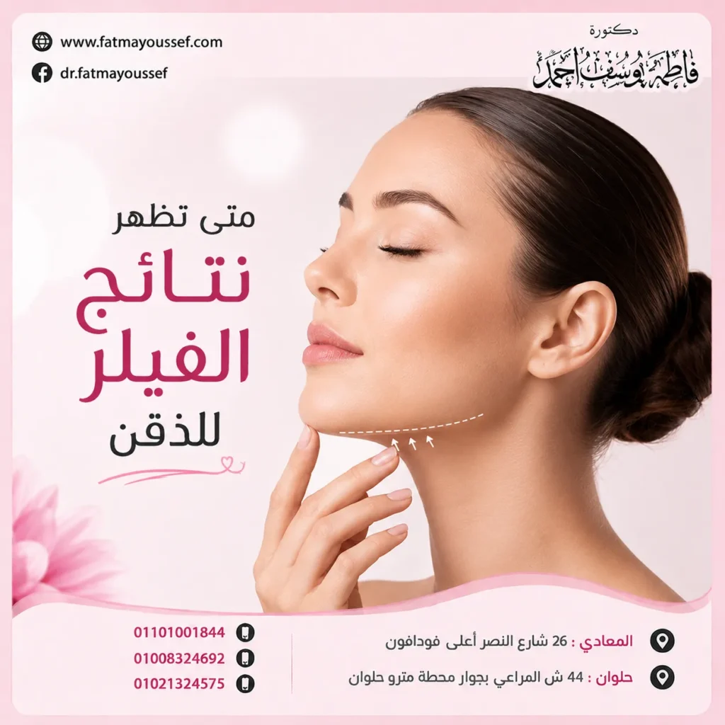 إنفوجرافيك يوضح أن نتائج فيلر الذقن تمر بمرحلة استقرار قبل ظهور الشكل النهائي