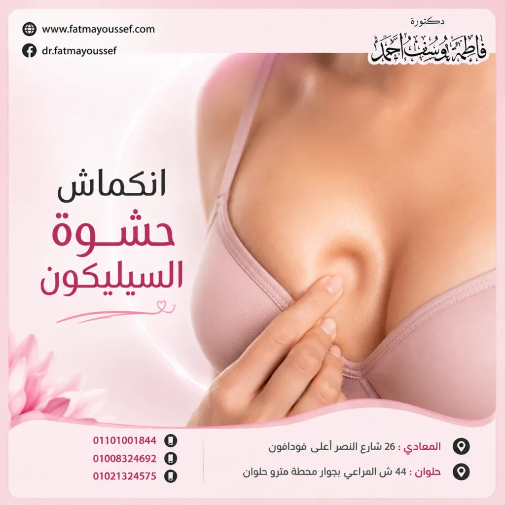 انكماش حشوة السيليكون