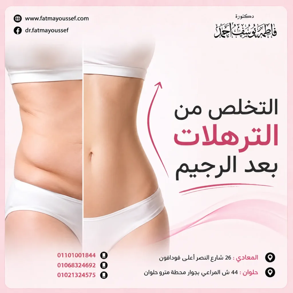 التخلص من الترهلات بعد الرجيم