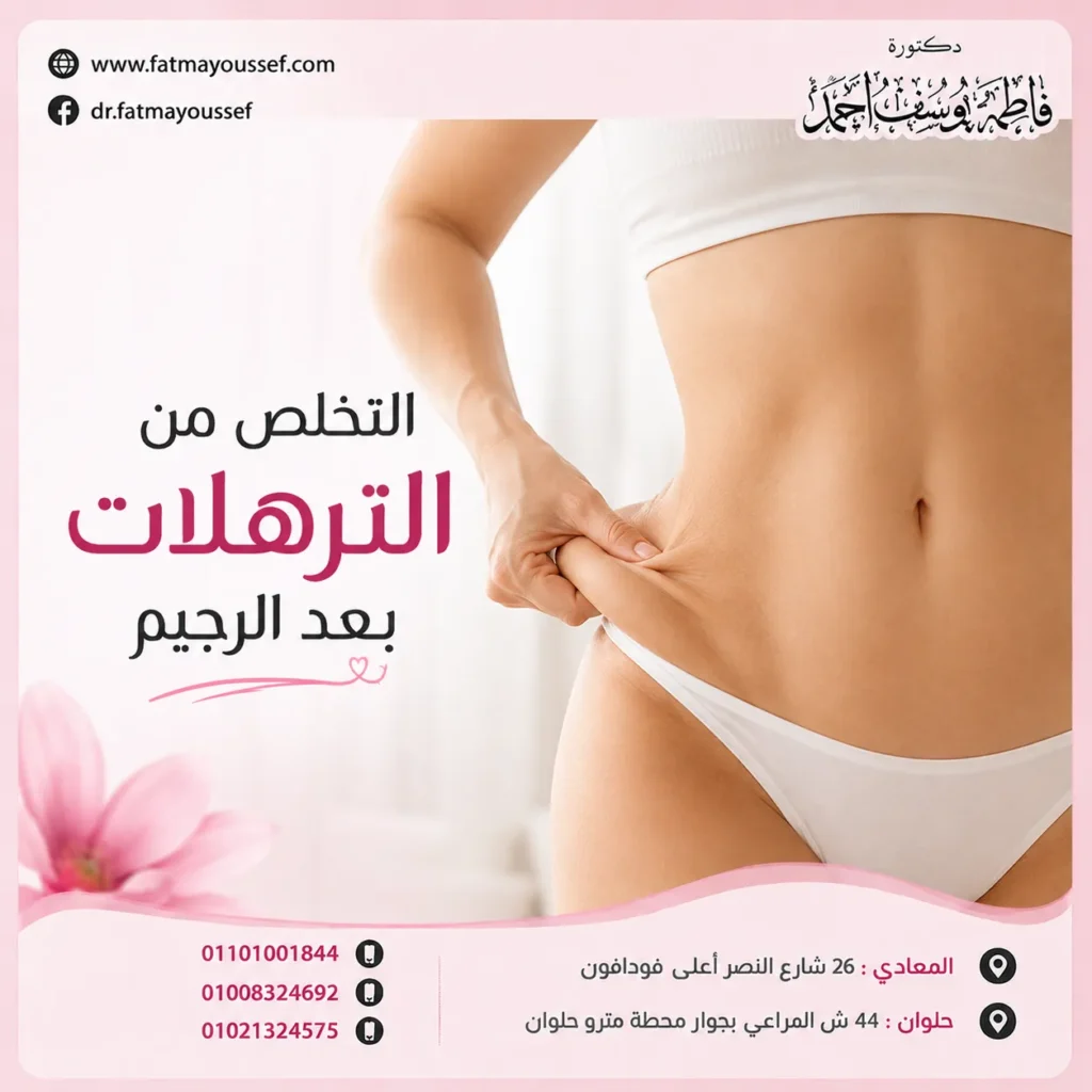التخلص من الترهلات بعد الرجيم