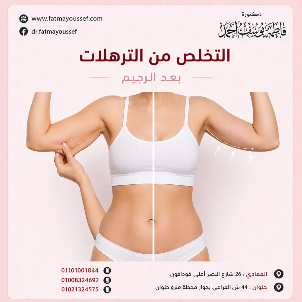 التخلص من الترهلات بعد الرجيم